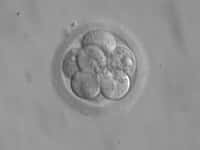 Les embryons humains contiennent des cellules souches pluripotentes voire totipotentes, capables de se différencier en n'importe quel tissu. Cette propriété intéresse des scientifiques, qui y voient l'occasion de soigner des maladies aujourd'hui incurables. Mais une telle récolte, réalisée dans les toutes premières phases de développement,&nbsp;s'accompagne de la destruction de l'embryon, ce qui soulève des questions éthiques.&nbsp;© Ekem, Wikipédia, DP