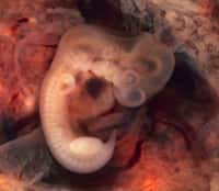 Embryon de dix millimètres issu d'une grossesse ectopique. Dans de nombreux cas, la grossesse extra-utérine peut nécessiter une prise en charge hospitalière d’urgence. © Ed Uthman, Wikipédia, DP
