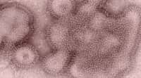 Une nouvelle souche grippale, A (H3N2v), vient inquiéter les autorités américaines. En 1 mois, 152 cas ont été recensés. Pour l'instant, ce virus ne se transmet pas d'Homme à Homme. © CDC Atlanta