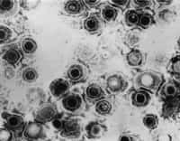 La multiplication du virus de l'herpès, vu ici au microscope électronique, peut être inhibée grâce à l'augmentation du microARN miR-199a-3p dans la cellule. Crédits DR.