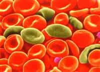 Crédits :  INSERM .Codocytes (cellules en casque, en cloche) examinés sur frottis sanguin au microscope à balayage. Ce sont des erythrocytes pathologiques. On les rencontre dans les thalassémies.