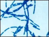 Anthrax bacteria, bacillus anthracis, as seen under a microscope.University of California -Davis