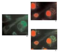 Infection de macrophages humains par le parasite Leishmania.a, marquage du noyau de la cellule et des parasites par le iodure de propidium.b, immunofluorescence avec un anticorps anti-leishmania.c, supperposition des deux images&co