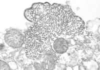 Image en microscopie électronique du virus Nipah.crédit: courtesy of C.S. Goldsmith and P.E. Rollin (CDC), and K.B. Chua (Malaysia).