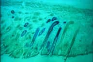 Crédits : INSERM / Identification des cellules souches capables de régénérer l'épiderme, les glandes sébacées et les follicules pileux. Greffe de cellules souches sur la peau du dos d'un embryon de souris. Morphogenèse