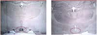 Ces microphotographies montrent une coupe de l'hypothalamus de rats soumis à un régime riche en protéines (à gauche) et de rats témoins (à droite). Les taches sombres révèlent la présence de facteurs impliqués dans la mise en place de la sensation de sati