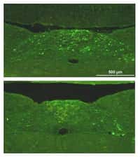 Tissus neuronaux d'une souris normale (en haut) et d'une souris mutante (en bas). Les points vert clair représentent les marqueurs biologiques de la noradrénaline, substance régulatrice du rythme de la respiration. Ils sont moins nombreux à droite, ce qui