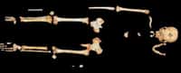Le statut du squelette "Hobbit" retrouvé sur l'île de Florès divise la communauté scientifique (Crédits : SUSAN LARSON/STONY BROOK UNIVERSITY)
