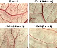 HB-19 inhibe la formation de vaisseaux sanguins. En haut à gauche, le contrôle, ensuite les résultats avec des quantités croissantes (en nanomoles). © PlosOne/Les auteurs de l'étude