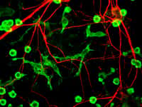 Le nombre de neurones chez une personne&nbsp;est estimé entre 86 et 100 milliards, et il&nbsp;diminue au cours des années.&nbsp;©&nbsp;Journal of Cell Biology, Flickr, cc by nc&nbsp;sa 2.0
