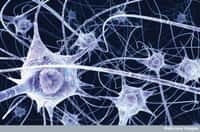 Pour maintenir son cerveau en bonne santé, il faut l'utiliser et le stimuler. En renforçant les neurones et les connexions qu'ils établissent les uns entre les autres, on pourrait ralentir la progression des tumeurs. © Benedict Campbell, Wellcome Images, Flickr, cc by nc nd 2.0