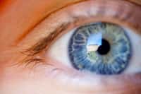 L'amblyopie est un trouble de la vision fréquent. L'œil faible ne peut focaliser correctement l'image, entraînant une mauvaise vision centrale et des difficultés pour bien voir de loin. Selon les scientifiques, il pourrait s'agir d'une interférence entre le signal nerveux émanant de l'œil fort, qui inhiberait celui provenant de l'œil malade.&nbsp;© Laurence Vagner, Flickr, cc by nc sa 2.0