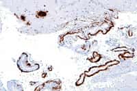 Les bêta-amyloïdes, ici marquées en marron, était déjà connues pour abaisser l'efficacité de la communication entre neurones. Désormais, on sait qu'elles semblent aussi favoriser la prolifération de la protéine Tau, qui pousse le neurone à entrer en phase de division cellulaire et à mourir. © Nephron, Wikipédia, cc by sa 3.0