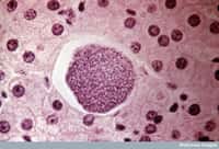 Plasmodium vivax, ici au milieu de cellules hépatiques, est responsable de plus de 100 millions de cas de paludisme à travers le monde chaque année, et épargnait jusque-là l'Afrique subsaharienne. Mais une duplication génique pourrait changer la donne... © Wellcome Library, Wellcome Images, cc by nc nd 2.0