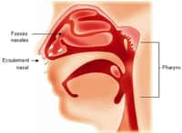 La rhinopharyngite est une atteinte inflammatoire du pharynx, associée à une atteinte des fosses nasales. Crédits GSK