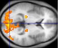 L'imagerie par résonance magnétique fonctionnelle (IRMf) permet d'observer l'activité du cerveau lors d'une stimulation. © Wikimedia Commons,&nbsp;DP