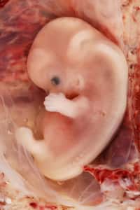 Durant la grossesse, le fœtus peut emmagasiner des modifications épigénétiques du fait de perturbations dans son environnement. Celles-ci, qui se transmettent lors des divisions cellulaires, pourraient être à l'origine de cancers infantiles. © Euthman, Fotopedia, cc by 2.0