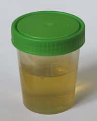 Chaque jour, en moyenne, un individu sans pathologie sécrète environ 1L d'urine. De quoi créer pas mal de cellules du cerveau !&nbsp;© Polarlys, Wikipédia, cc by sa 3.0