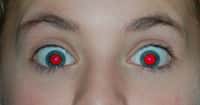 L’effet yeux rouges se produit lorsque la lumière du flash d’un appareil photo vient frapper le fond de l’œil. © PeterPan23, Wikipedia, DP