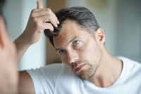 Si l’on perd en moyenne entre 40 et 100 cheveux par jour, la chute de cheveux peut devenir pathologique au-delà. © goodluz, Adobe Stock