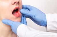 Un dentiste examine une lésion dans la bouche d'une jeune femme. © Henadsy, Adobe Stock