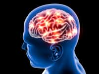 Dans les cerveaux de patients souffrant de maladie d’Alzheimer se forment des plaques amyloïdes. De telles structures ont été retrouvées chez des patients ayant eu une greffe de dure-mère. © Naeblys