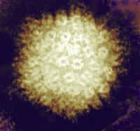 Le virus varicelle zona (VZV) est, comme son nom l'indique, responsable de la varicelle et du zona. Une fois la varicelle passée, il peut se cacher dans les ganglions et réapparaître plus tard sous la forme de zona. Selon cette étude, il pourrait augmenter le risque d’accidents vasculaires. © NIAID, Flickr, cc by 2.0
