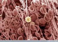 Les caillots sanguins sont constitués de cellules sanguines et de protéines particulières qui forment des fibres. Lors d’une infection, ils empêchent les envahisseurs de se faufiler dans l’organisme. Ils peuvent aussi absorber les toxines bactériennes. © Wellcome images, Flickr, cc by nc nd 2.0