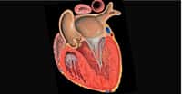 Coupe frontale dans le ventricule gauche du cœur humain. © Patrick&nbsp;J. Lynch - CC BY-NC 2.5