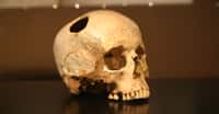 Crâne de jeune fille trépané au silex, Néolithique (3500 Av. JC). © Rama - CC BY-SA 2.0 FR