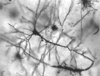 Les neurones testés chez la souris par les chercheurs dans cette étude se trouvaient dans l’hippocampe, comme ceux de cette photo. © MethoxyRoxy, Wikimedia Commons, cc by sa 2.5