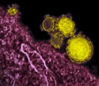 En fausses couleurs, des virus&nbsp;MERS-CoV (Middle East Respiratory Syndrome Coronavirus) observés au microscope électronique à transmission. Ce parasite appartient à la famille des coronavirus, caractérisés par une coque protégeant le matériel génétique, constitué d'ARN. © NIAID/AJ Cann, CC by sa 2.0