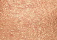 La peau se renouvelle en permanence, les cellules mortes étant éliminées sous forme de squames. © nataba, Adobe Stock