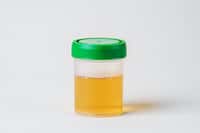 La couleur jaune de l’urine est liée à la présence d’urobiline. © adragan, Adobe Stock