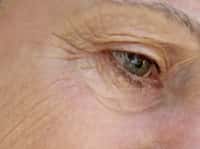 De la myopie à la presbytie : soigner tous les troubles de la vue par la chirurgie réfractive. © Phovoir