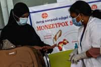Variole du singe, Monkeypox… L'OMS envisage de modifier&nbsp;le nom des différentes souches du virus, ainsi que celui de la maladie elle-même.&nbsp;© Arun Sankar, AFP