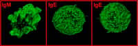 Lymphocytes B visualisés en microscopie confocale (x 1.000). Le cytosquelette (molécules d’actine) est marqué par une sonde fluorescente verte (phalloïdine FITC). Les lymphocytes B avec une IgM à leur surface ont des protubérances (pseudopodes) témoignant de leur mobilité alors que les lymphocytes B IgE+ perdent ces structures et deviennent immobiles. © CNRS, laboratoire « Contrôle de la réponse immune B et lymphoproliférations »
