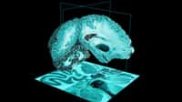 BigBrain, l’atlas 3D haute résolution du cerveau humain