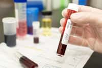 Un deuxième cas d'élimination du VIH sans greffe ni traitement a été identifié. © mrtom-uk, IStock.com