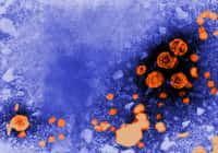 Le virus de l'hépatite B. ©&nbsp;US Centers for Disease Control