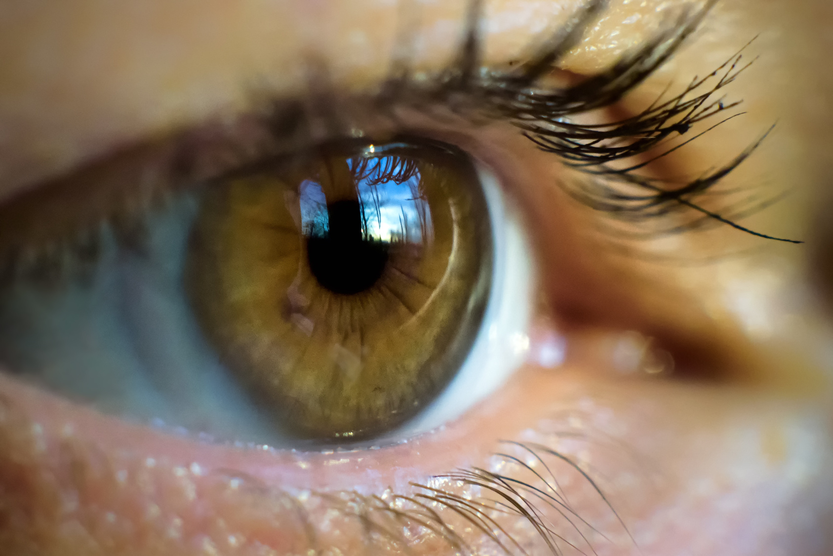 Un simple scan de l'œil pourrait prédire le risque de crise cardiaque. © scaliger, Fotolia