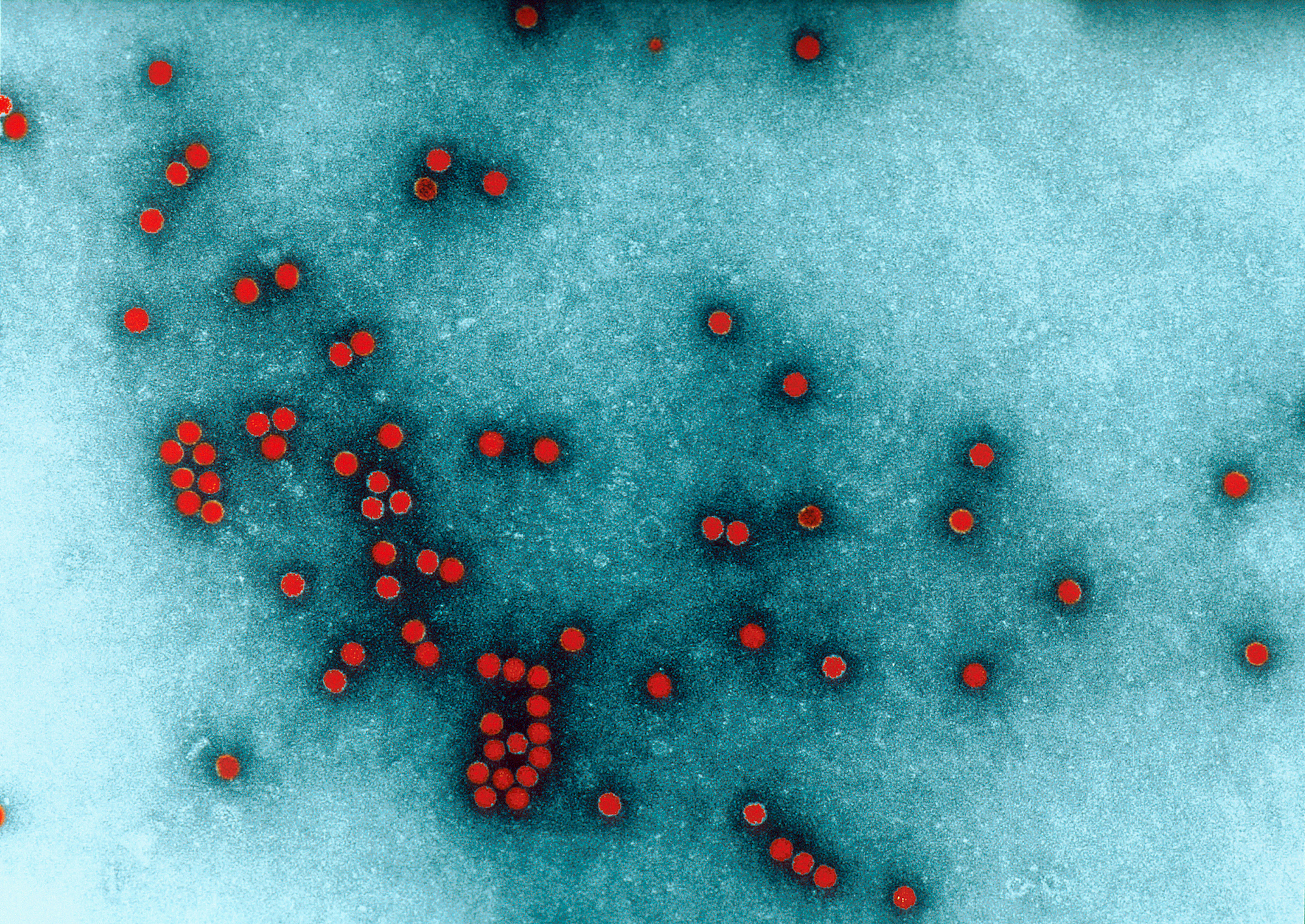 Image du virus de la poliomyélite au microscope électronique. © Charles Dauguet, Institut Pasteur