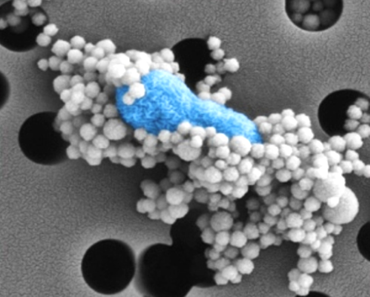 Des nanobilles magnétiques recouvertes de protéine MBL se fixent à une bactérie (colorée en&nbsp;bleu) de type Escherichia coli sur cette image prise au microscope électronique. On peut se servir de ce phénomène pour faire une sorte de dialyse qui va collecter magnétiquement les nanobilles et ainsi retirer du sang&nbsp;une grande partie des bactéries auxquelles elles sont collées. © Harvard's Wyss Institute