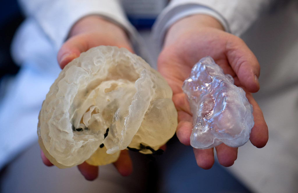 Deux modèles&nbsp;d'un cerveau d'un patient, réalisés avec des matériaux différents et destinés à l'équipe chirurgicale qui pourra s'exercer avant l'intervention. © Boston Children’s Hospital