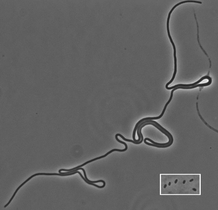 Deux chercheurs de l’université Concordia à Montréal ont observé une bactérie E. coli qui ne se divise pas mais qui continue néanmoins de vivre normalement. © Ziad El-Hajj