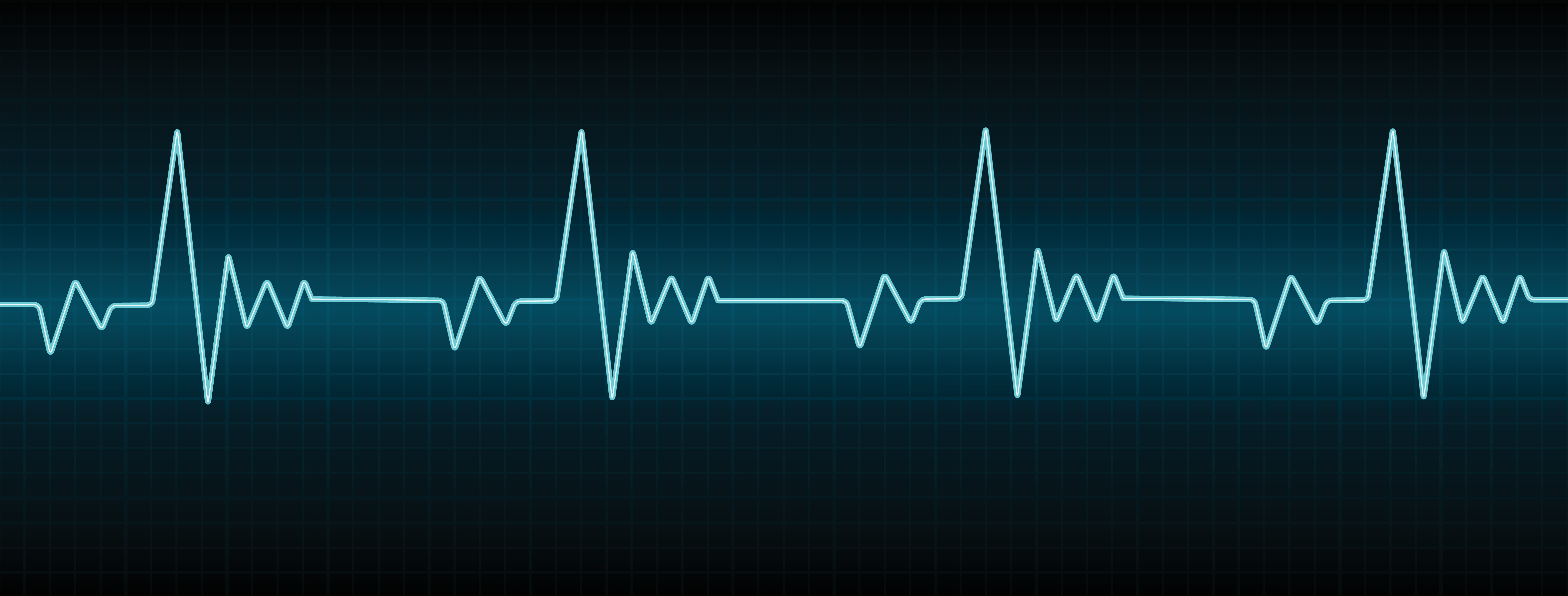 Cette image représente un électrocardiogramme normal, et chaque onde P, Q, R, S et T est signalée. © Vector Bucket, Adobe Stock