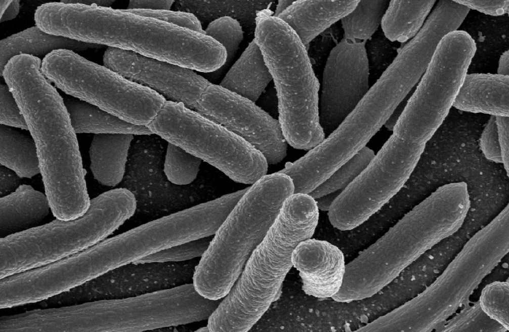 Escherichia coli, ici observée par microscopie électronique, vit dans notre intestin et sert de modèle bactérien en génétique. © Elapied, Wikimedia Commons, DP
