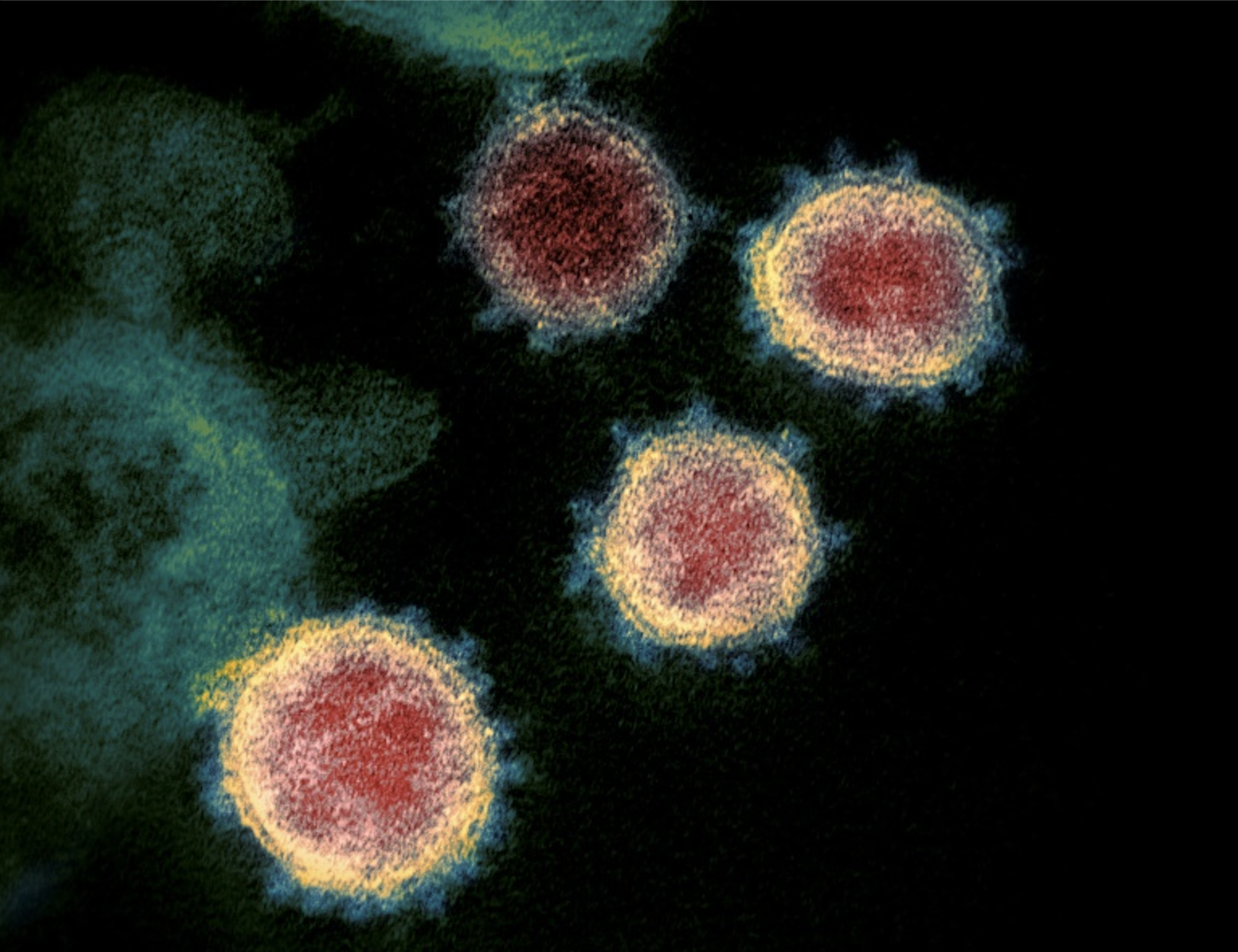 Le coronavirus SARS-CoV-2 infecte les cellules par l'intermédiaire de deux protéines cellulaires ACE2 et TMPRSS2. © Handout, National Institute of Health, AFP Archive