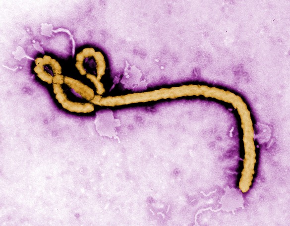 Le virus Ebola est un filovirus (de forme filamenteuse) et dont le génome est constitué d'ARN. Très contagieux, il provoque chez les primates des fièvres, des hémorragies et une immunodépression (c'est la maladie à virus Ebola, auparavant appelée fièvre hémorragique), avec un taux de létalité élevé. © CDC, Frederick A. Murphy