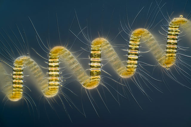 Ce cliché&nbsp;d'une colonie hélicoïdale de diatomées Chaetoceros debilis a gagné l'édition 2013 du concours Nikon Small World, section photomicrographie. Il&nbsp;a été réalisé par Wim van Egmond à l'aide d'un microscope&nbsp;à contraste interférentiel.&nbsp;©&nbsp;Wim van Egmond